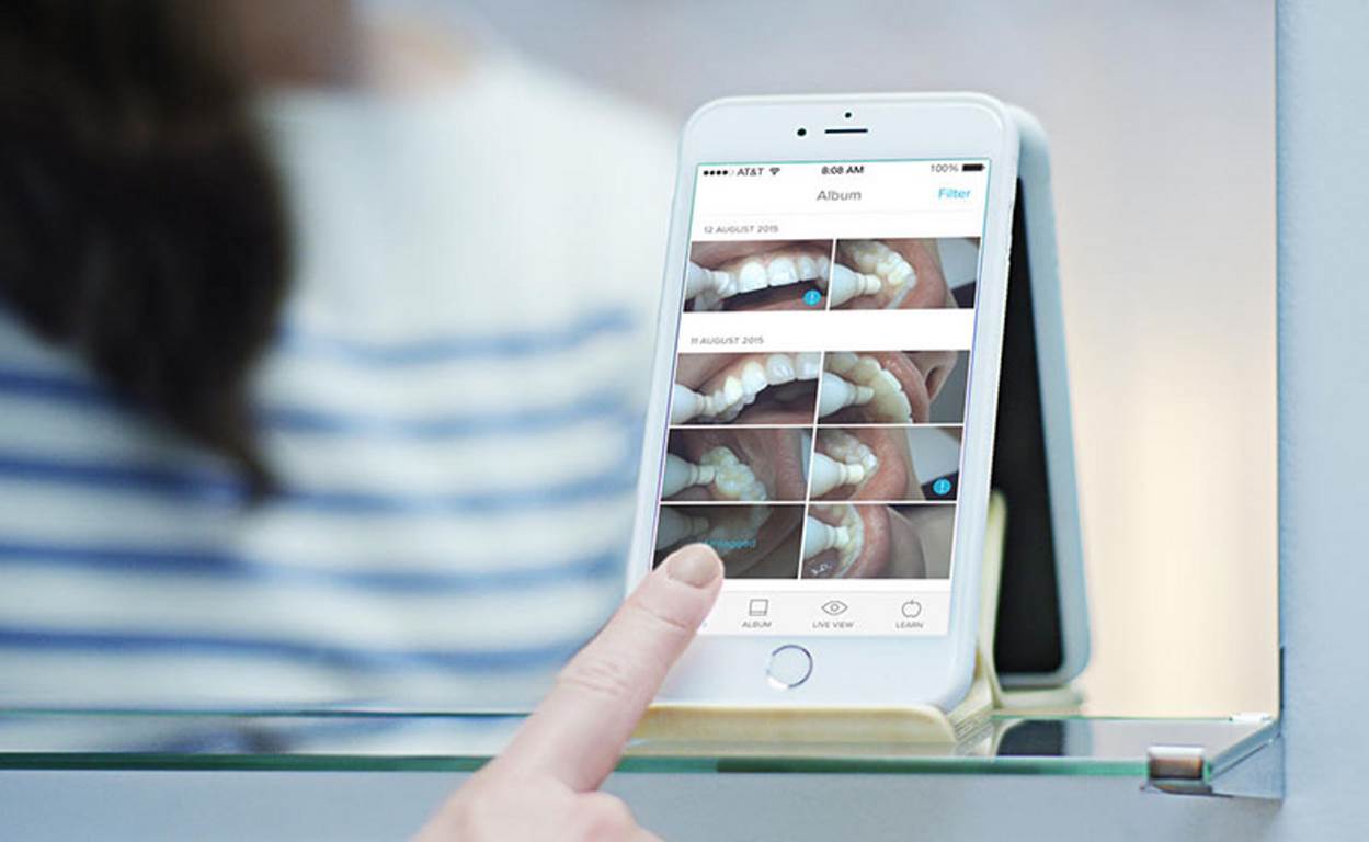 فیلمبرداری از دهان