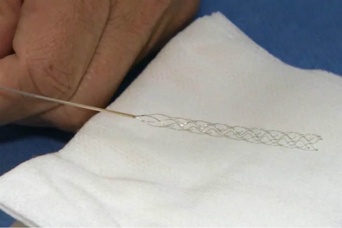 سیم پیچ دور رگ ها