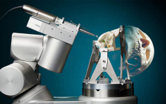 جراحی مغز با ربات جراح مغز تنها در دو دقیقه و نیم!